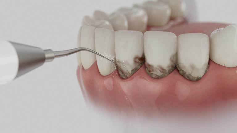 Reliable Dental Implants contractor in Loyola, CA by Smile Center Dentistry